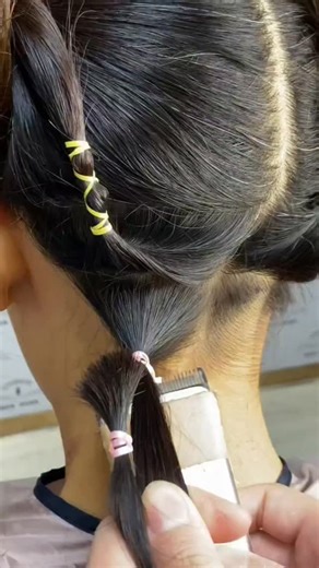 Dr.Qiao Mu on Instagram: "A dramatic transformation from bald to beautiful eyebrows 🌿 #EyebrowTransplant #TheImportanceOfEyebrows #NaturalAndBeautifulEyebrows"