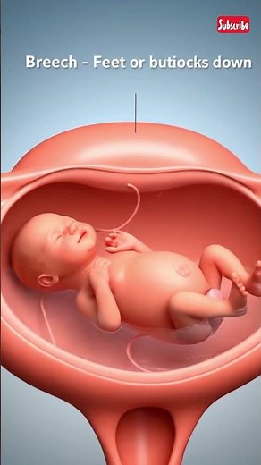 Fetal Position During Pregnancy: Cephalic, Breech & Transverse Explained by 3D Animation System