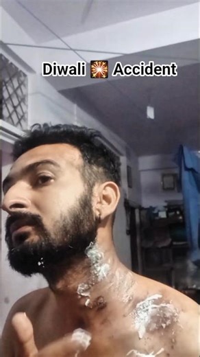 Diwali Vlog Gone Wrong 😱 | Unexpected Accident on Diwali Night