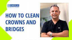 How to Clean Crowns and Bridges At Home? | SmilePerfectors