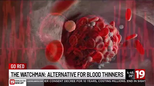 Alternative to blood thinners providing AFib patients the same protection from stroke