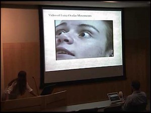 Dorsal Midbrain Syndrome: A Discrete Lesion resulting in Parinaud's Syndrome