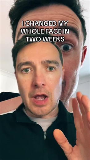 absolute game changer #skincare #antiaging #drmelaxinbalm #drmelaxinskincare