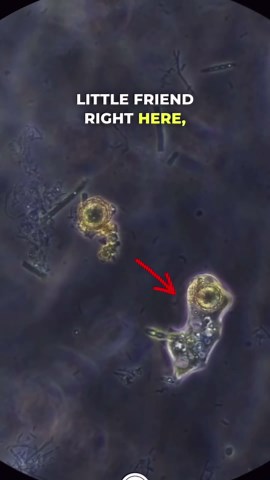 Brain-Eating Amoeba: How It Spreads and How to Stay Safe