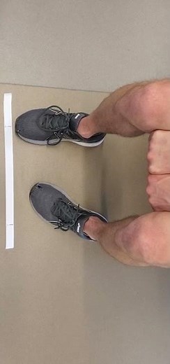 Knee - Assessment - Tibial Rotation