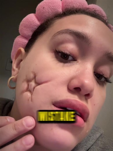 user2613286652519 (@user2613286652519)’s video of girl with scar on her face