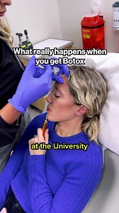 Neuromodulators: Botox, Dysport, Xeomin