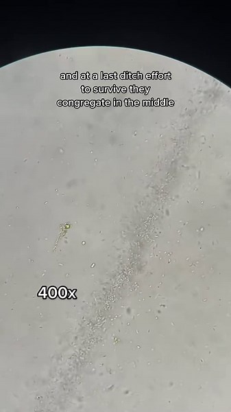 A Close-Up Look at Bacteria Fighting to Survive