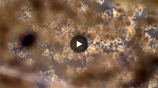 Freshly hatched Amblyomma americanum larvae - my tech (Kelly) took this video in the lab yesterday.....so cool to watch! | Richard Thomas Marconi