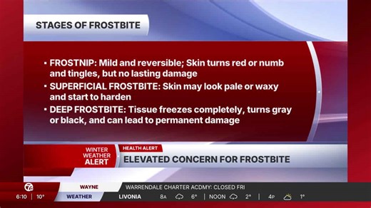 What you need to know about the 3 stages of frostbite