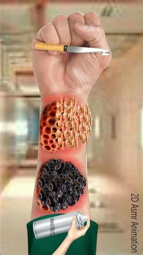 #asmr #satisfying #ticking #animation #dogticks #dogticks #treatment #relaxing #dogticksremoval