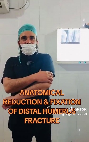 Anatomical Fixation Techniques for Distal Humerus Fractures