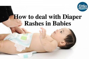 19K views · 181 reactions | How to Deal with Diaper Rashes in Babies. Learn more at https://www.littlesparenting.com/parenting/how-to-deal-with-diaper-rashes-in-babies/ | Healtheotic | Facebook