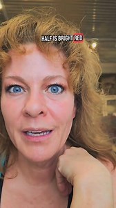 Understanding Harlequin Syndrome in a Newborn In this reel, I share a nursing story from the labor and delivery unit involving Harlequin syndrome in a newborn. This striking skin color change can look alarming but is usually harmless. If you're interested in nursing, true medical stories, newborn care, or the emergency room, this reel is for you. Follow me for more nursing stories, labor and delivery, and birth stories. #LaborAndDeliveryNurse #BirthStory #harliquin #medicaltruestory #NewbornCare