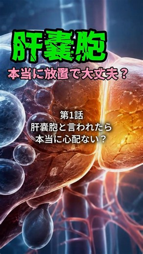 肝嚢胞、本当に放置で大丈夫？① 肝嚢胞と言われたら、本当に心配ない？