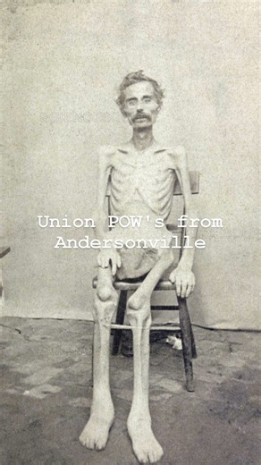 Civil War Prison Atrocities: Who To Blame? #americancivilwar #military #history