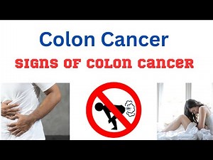 8 Signs of Colon Cancer in Women - Colon cancer statistics