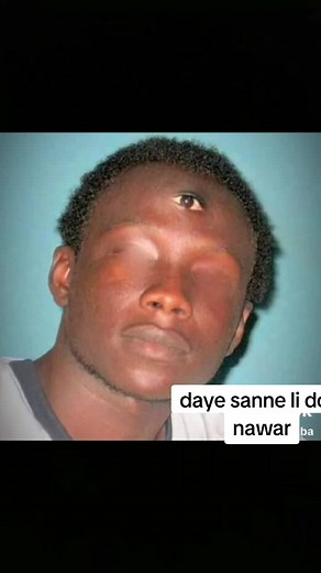 #daye 😂sanne 😂abonne rk😂 lawax amot lenen😂@boye thiam