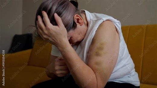 Woman Needs Help, Hurt Lady Displays Urgent Signs Demanding Immediate Medical Attention Now, Victimized Woman With Visible Injuries Urgently Calls For Emergency Medical Aid Without Delay