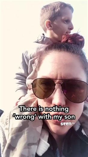 Raising Awareness for Primordial Dwarfism Support