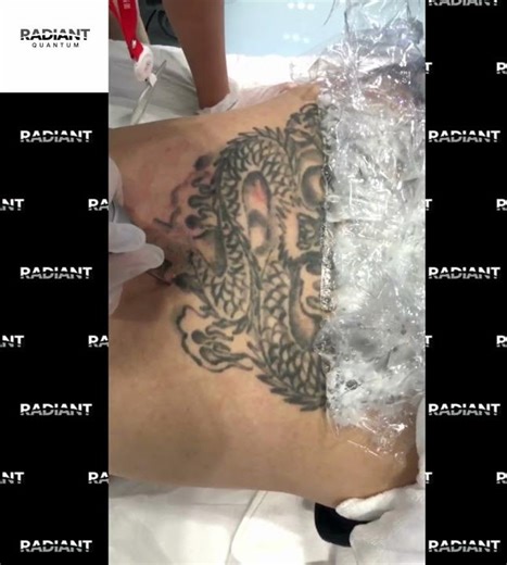 💥 Introducing the Radiant Quantum Laser