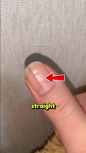 Why You Should Never Ignore This Nail Line