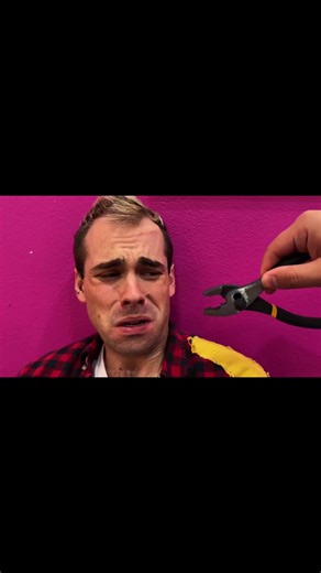 This is the worst tooth I've ever seen. poor vs rich patient dentist hospital #hospital #kpop #patient #poor #rich