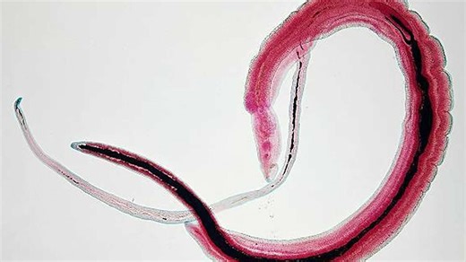 Scientists Warn of Parasite That Can Enter the Body and Increase Cancer Risk