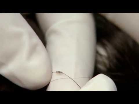 Head Lice - Identification