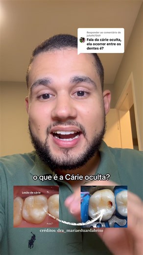 What is hidden tooth decay?