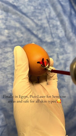 ‏No more worrying about your dark sensitive areas!😏 | Laser