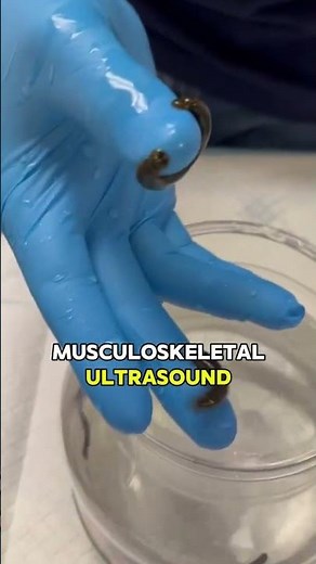 Leech Therapy for Shoulder Pain