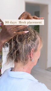 16M views · 540 reactions | A mesh integration hair system is a...