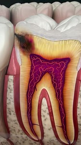 1.6K views · 23 reactions | NEW Endo Training with Dr. Gilbert LIVE THIS Wednesday! He's going to show you his "Pro Tips" on:  How to avoid perforation during Endo access.  How to ensure you don't miss a canal on any tooth.  And you'll also see an Endo Obturation DEMO- for single cone VS the warm vertical technique. All NEW- no cost. Join us LIVE This Wednesday! Register to watch here- https://bit.ly/endo-training-sept29 | Dr. Rinesh Ganatra | Facebook