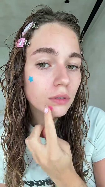 i love pimple patches | framboesa anna malyhom