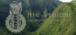 Tehe - Peritome