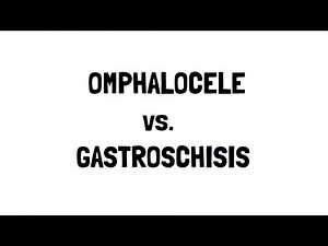 Omphalocele and Gastroschisis