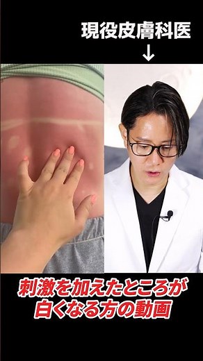 Why do handprints remain on sunburnt skin? A practicing dermatologist explains. #shorts