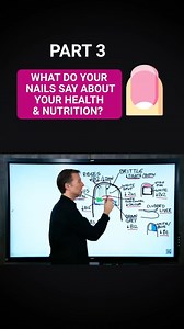 What Your Nails Reveal About Health & Nutrition – Part 3 Your nails can reveal a lot about your health and nutrition. In Part 3, discover key signs your nails show and what they mean for your well-being. #NailHealth #NutritionTips #HealthSigns #Wellness #SelfCare #HealthyNails #BodySignals #HolisticHealth #NutritionMatters #BeautyTips | Diet & healthy By Dr