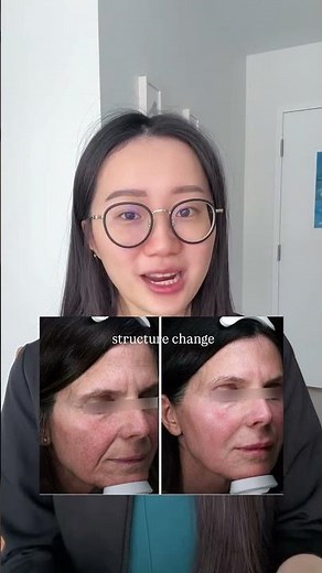 BBL vs LASERS vs RETINOL, a simple explanation.