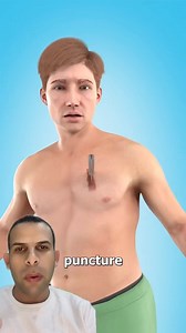 581 reactions · 21 shares | Three sided occlusive Dressing | Mohamed Kaneer | Facebook