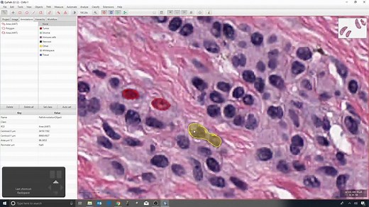 病理学切片开源处理软件QuPath官方教程 5 - Brush and wand