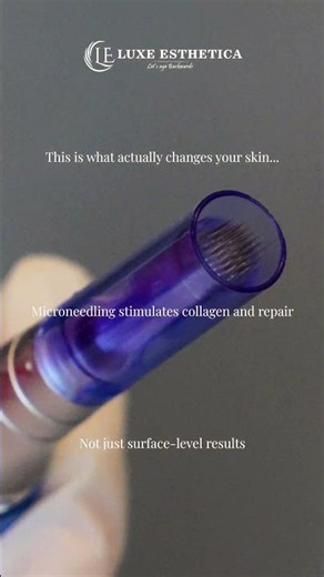 ✨ Reveal Your Best Skin with Microneedling at Luxe Esthetica! ✨