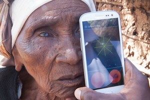 How a smartphone may revolutionize eye care