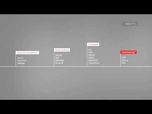 Sound Coding Development | MED-EL