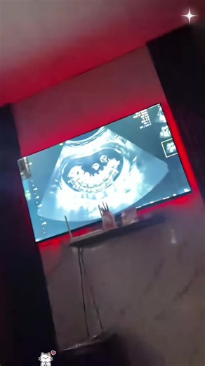 Tem vermes falsos na barriga do bebê | Tutorial de vermes falsos na barriga do bebê | Vídeo de ultrassom falso para crianças | Ultrassom falso para crianças Ultrassom com vermes na barriga | Vídeo simulador Paulo e Juju Vídeo com vermes falsos na barriga do bebê | Ultrassom falso | Vídeo de ultrassom falso infantil | Imagem de ultrassom falso de pegadinha | Ultrassom falso gerado por IA | Efeito sonoro de ultrassom falso Vídeo com vermes falsos na barriga do bebê | Tem vermes falsos na barriga d