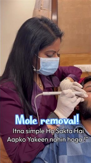 Mole Removal Procedure