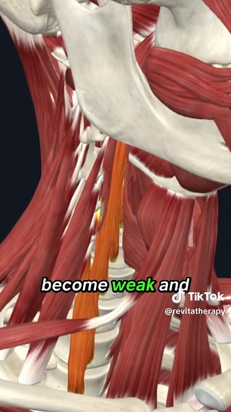 Effective Neck Pain Relief Through Strengthening Exercises