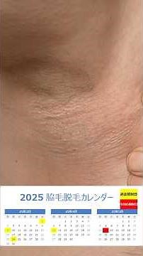 Armpit hair removal with Keon [5th time] I think it's much cleaner and takes less time than using...