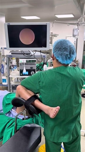 JJ stent removal under anesthesia #KidneyStoneRemoval #KidneyStoneRemoval #DoctorTung #UrinarySto...